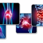 Research paper on joint pain: Research paper on joint pain: