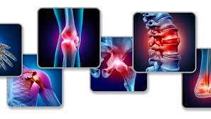 Research paper on joint pain: Research paper on joint pain: